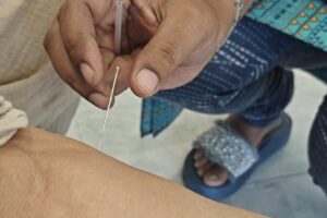 Dry Needling