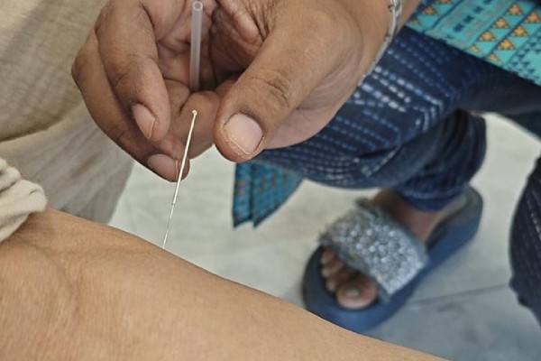 Dry Needling